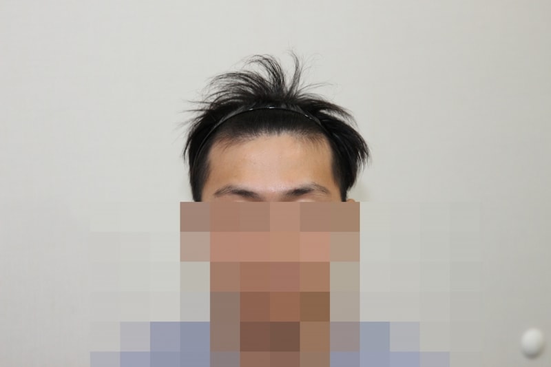 전 (1).JPG