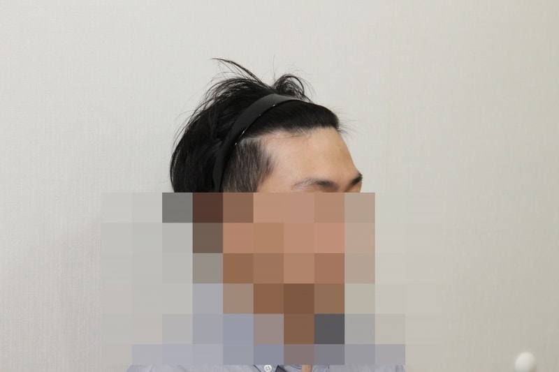 후 (3).JPG