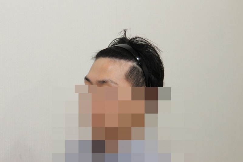 후 (2).JPG