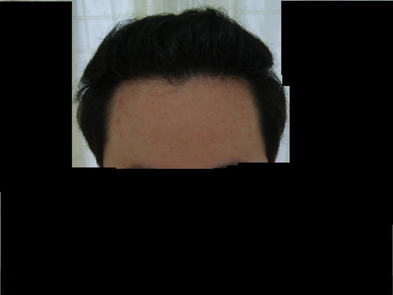크기변환_137일 경과3.JPG