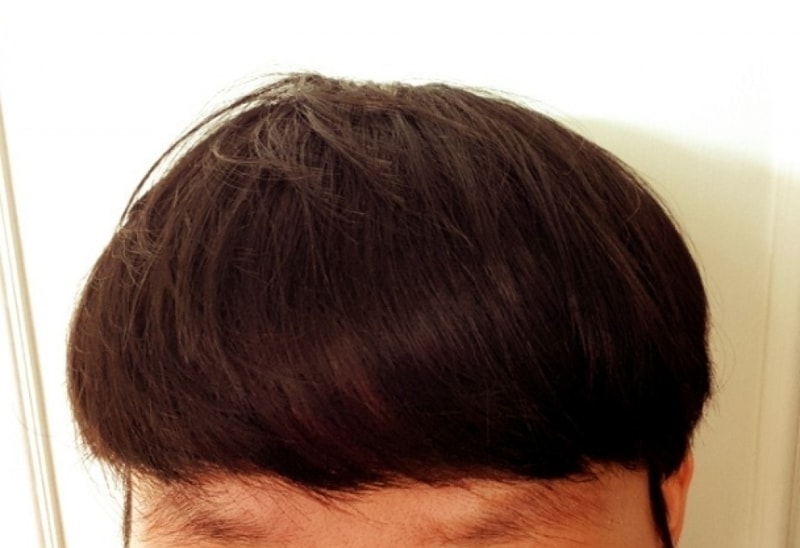 투데이 캐.PNG