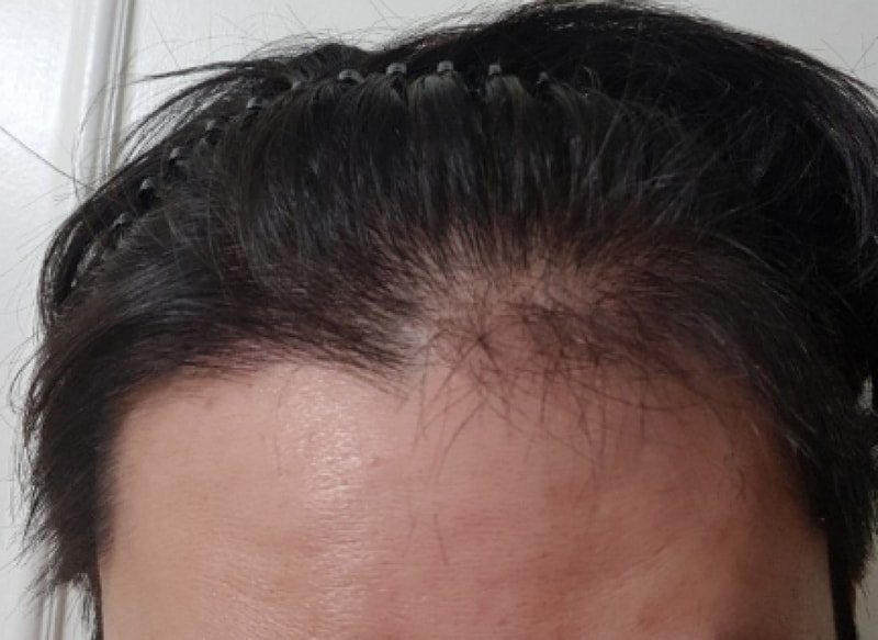 투데이 이마 캡쳐.PNG