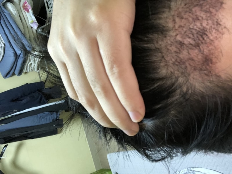 A994D8C5-A433-490B-AADB-1DA030238FDD.jpeg