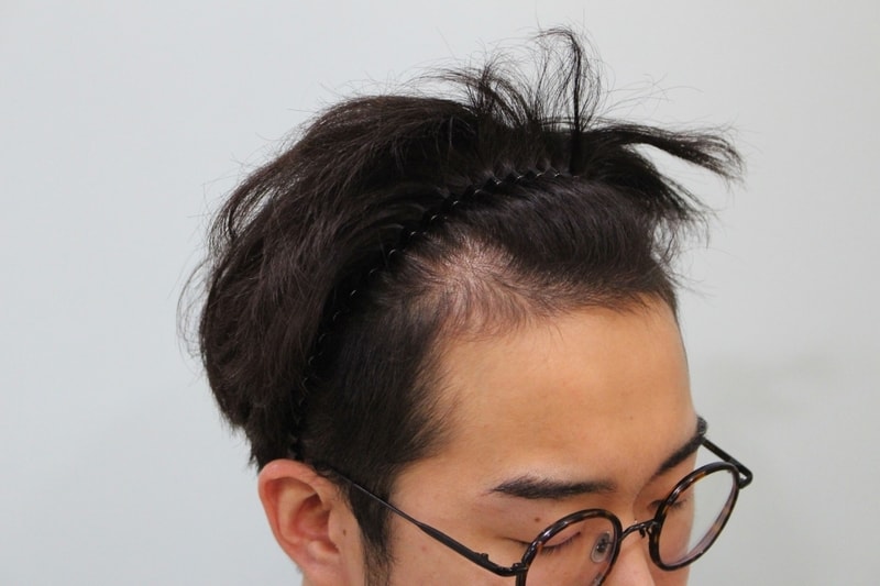 수술전 (2).jpg