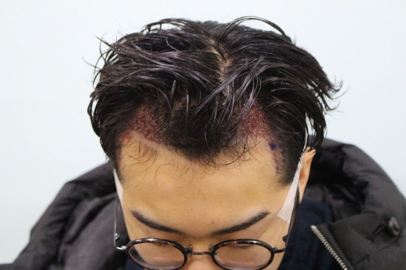 수술직후 (2).jpg