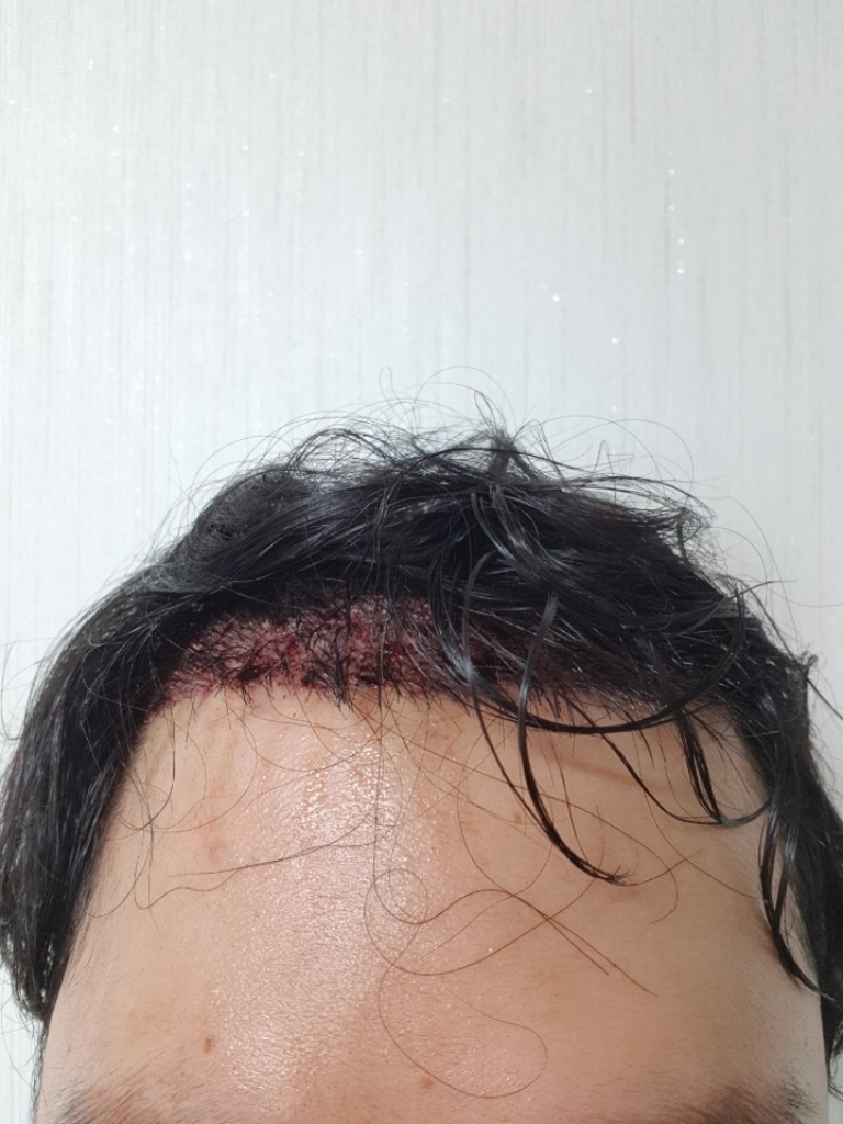 KakaoTalk_20180717_144359395.jpg