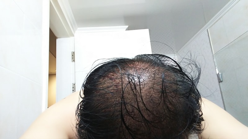 혼합 5000모 입니다 3차
