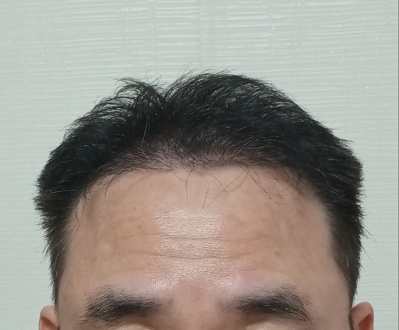 모재성 8개월차입니다.