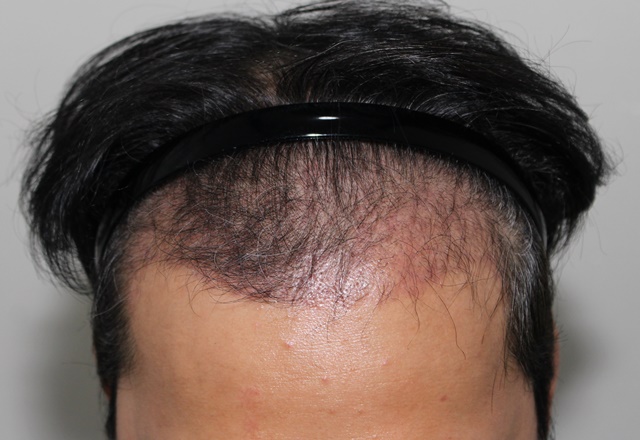 암흑기가 끝나고 슬슬 올라옵니다