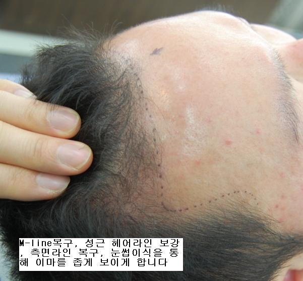 hair line design.JPG