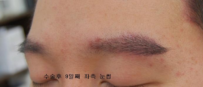9day Lt brow.JPG