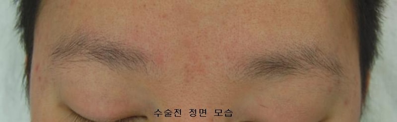 before.JPG