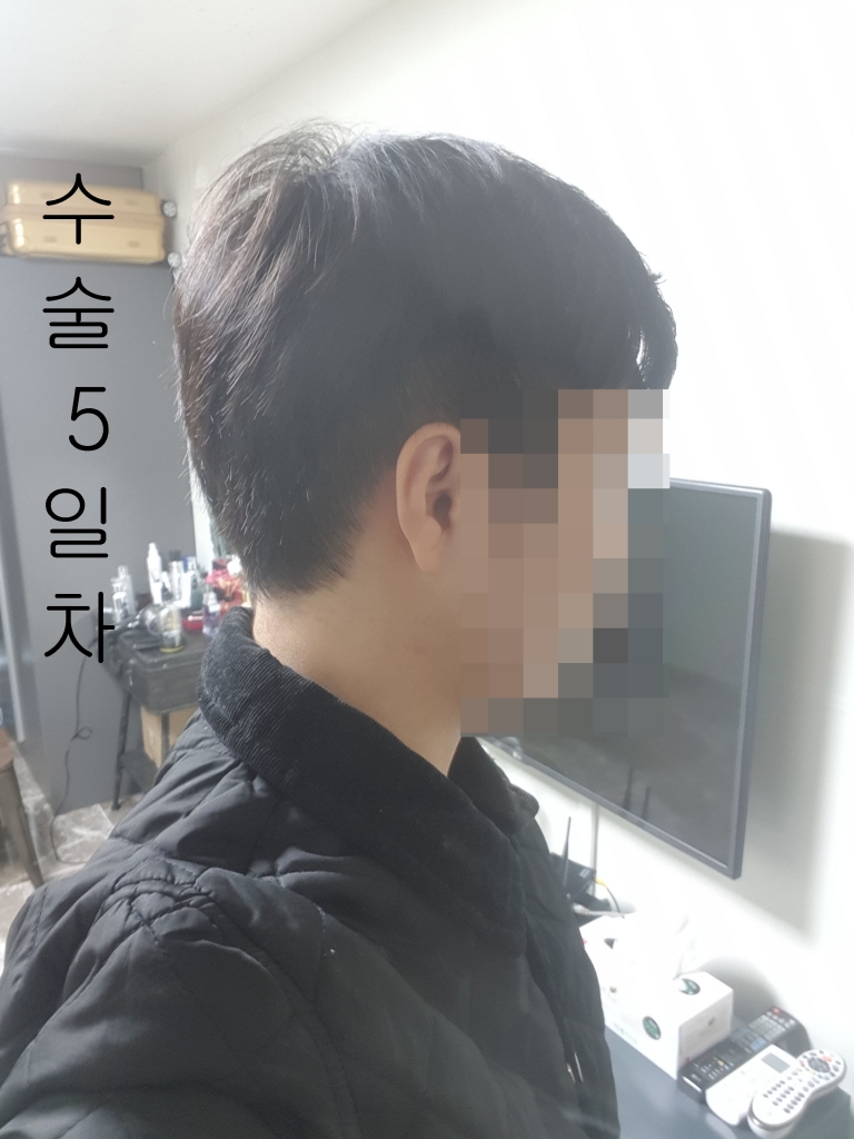 수술5일차2.jpg