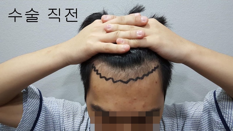 수술직전1.jpg