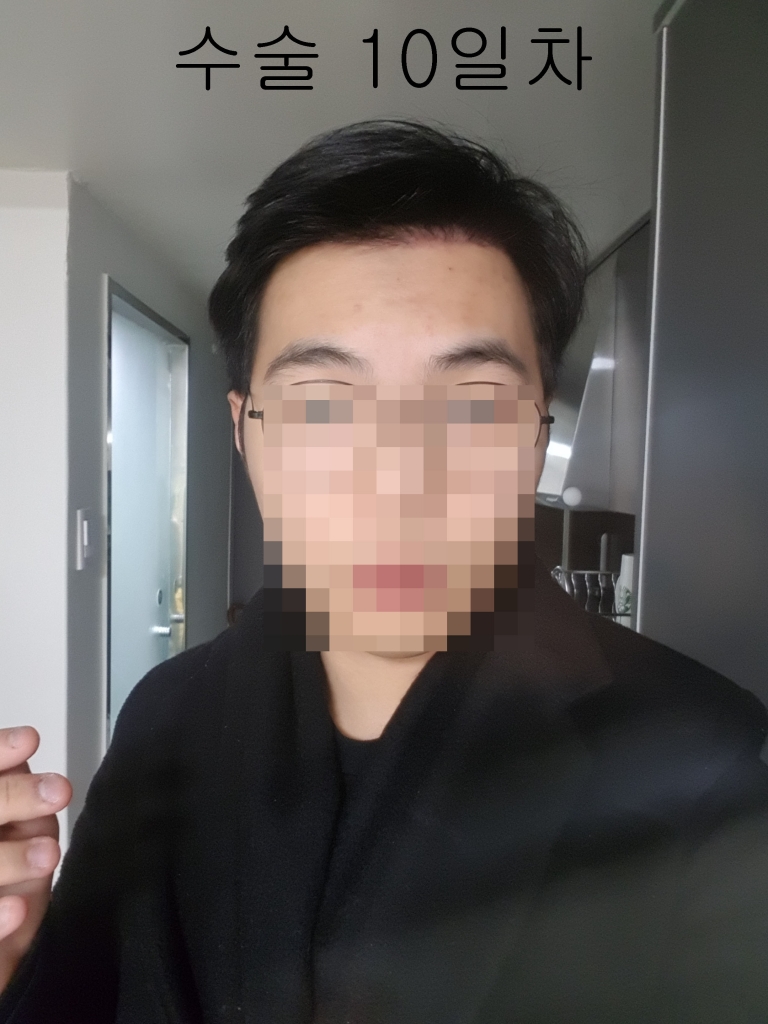 수술10일차3.jpg