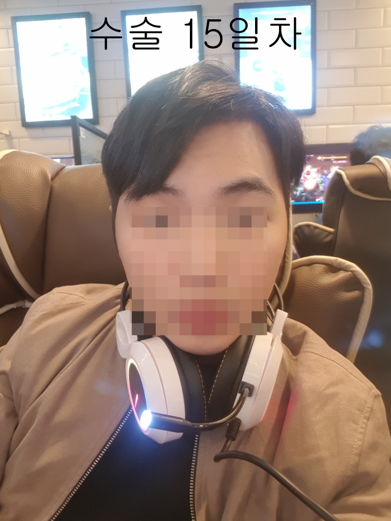 수술15일차4.jpg