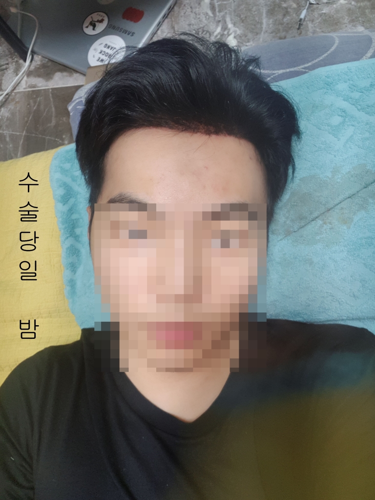 수술당일1.jpg