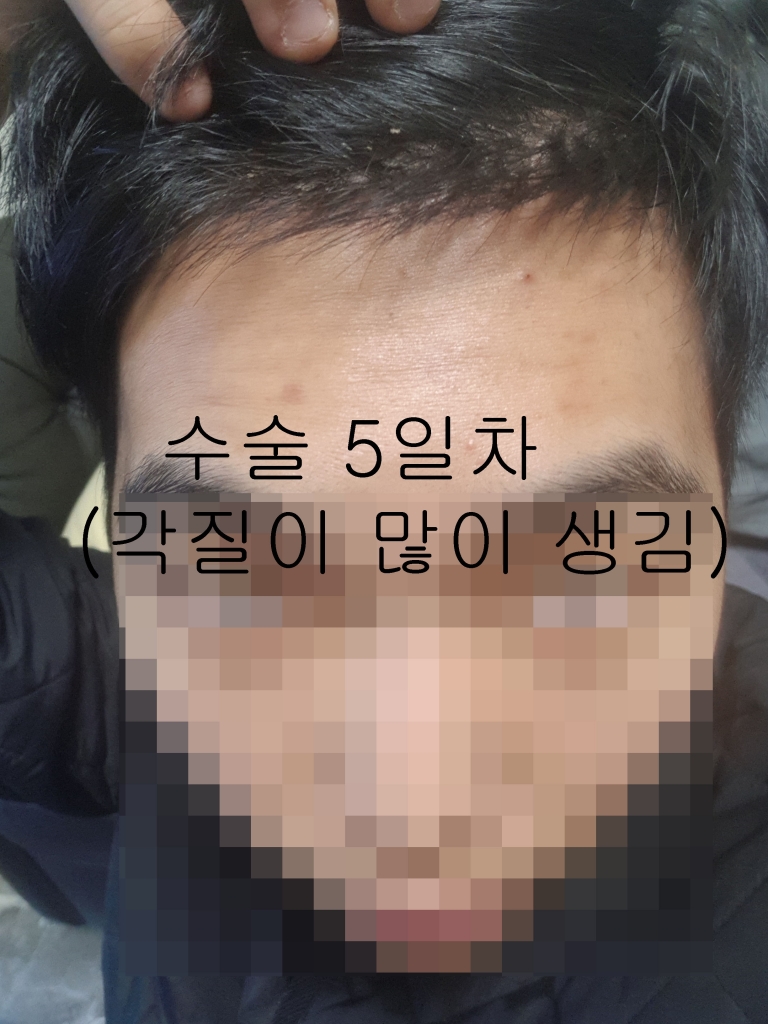 수술5일차1.jpg