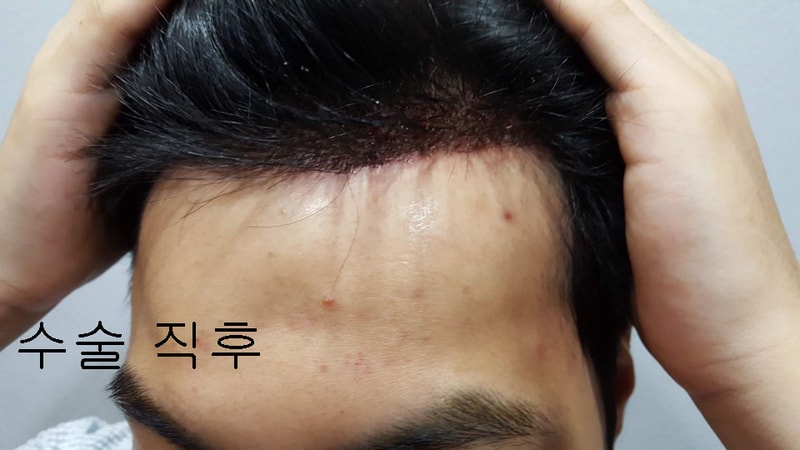 수술직후1.jpg
