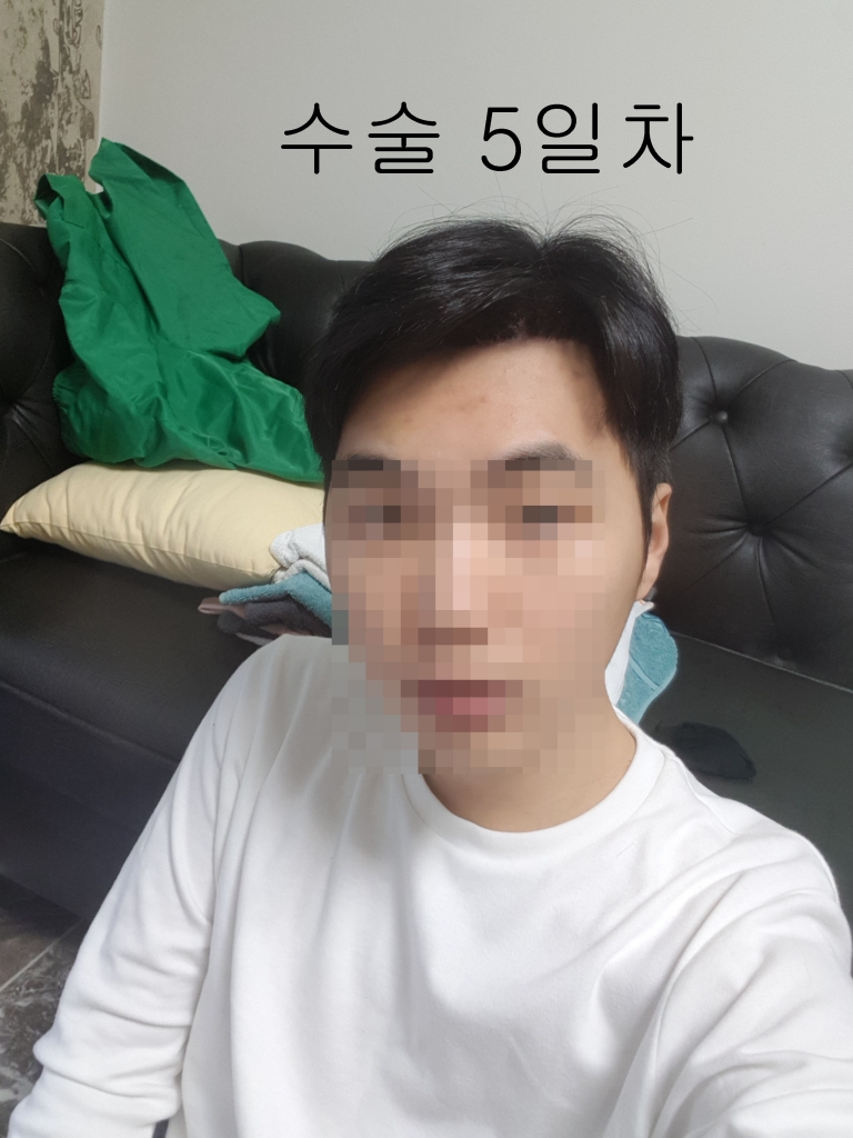 수술5일차3.jpg