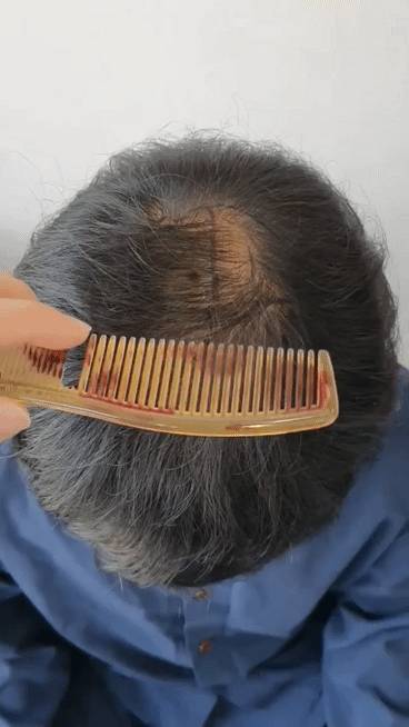 KakaoTalk_20240319_195654980_01.gif