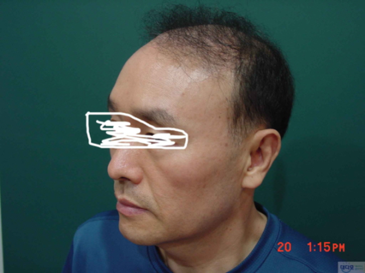 꾸미기_이준섭전,옆 - 복사본.jpg