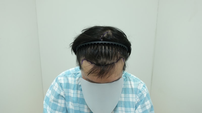 수술전.jpg