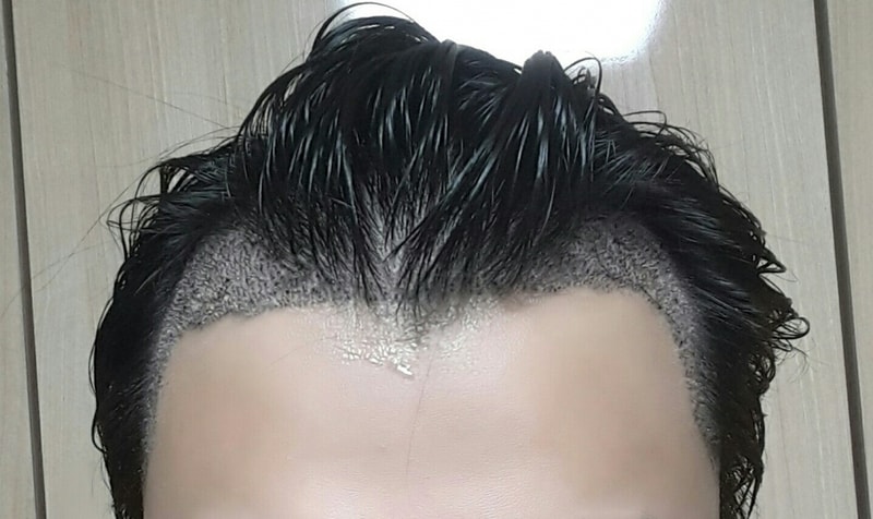 후.정면(오른올라감).jpg