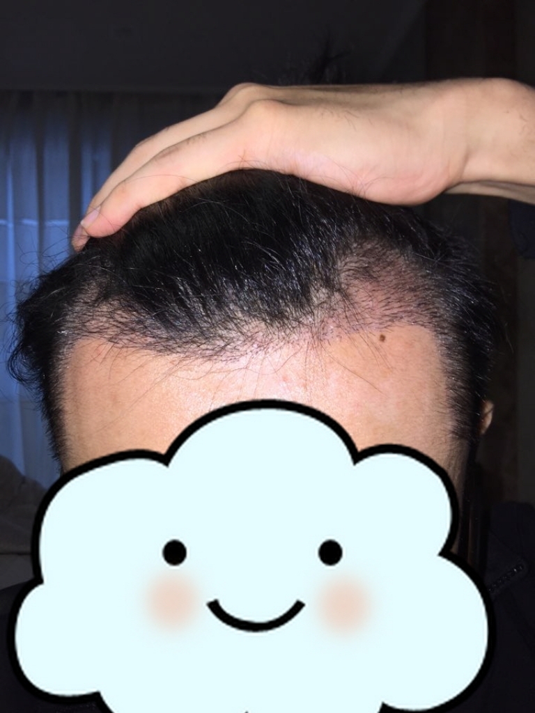 10일 1.jpg