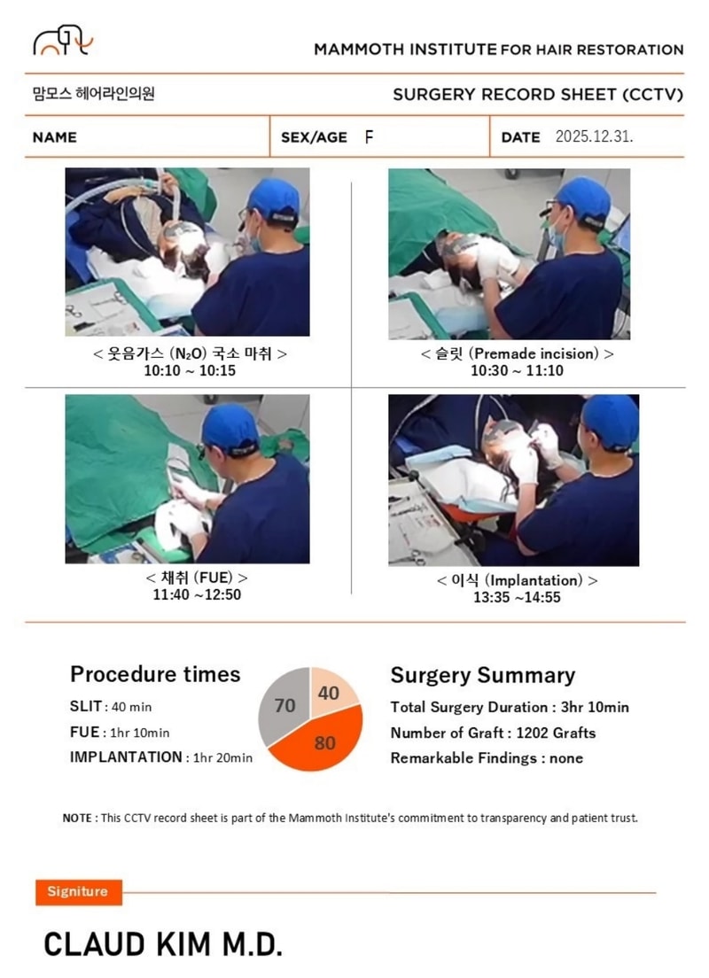 부산모발이식 슬릿방식 맘모스 헤어라인교정 1일차 후기