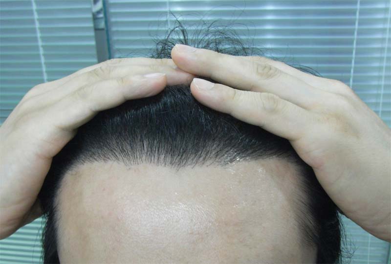 부산연산동8개월-2.jpg