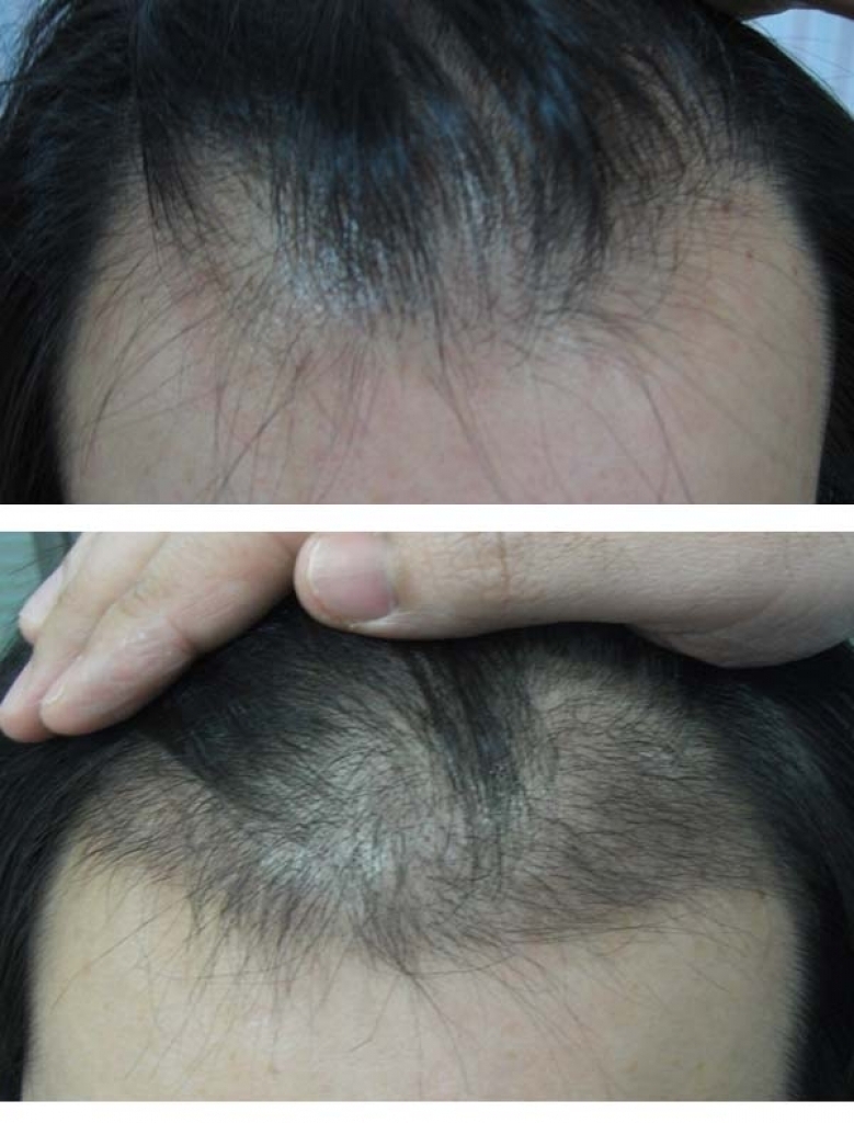 hairtr.jpg