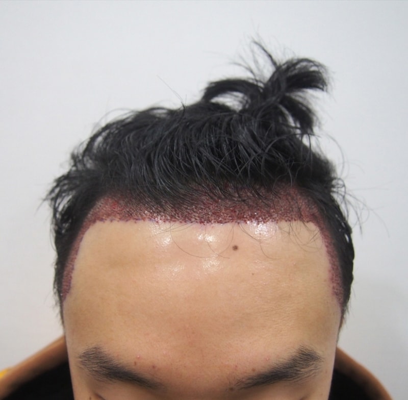 크기변환_20180105_143518.jpg