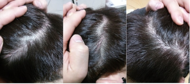 크기변환_후두부 모음.jpg