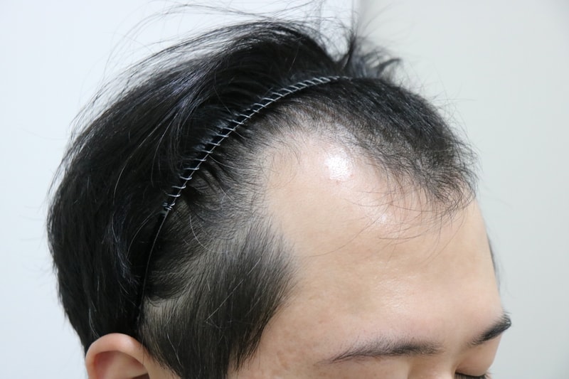 앞머리.jpg