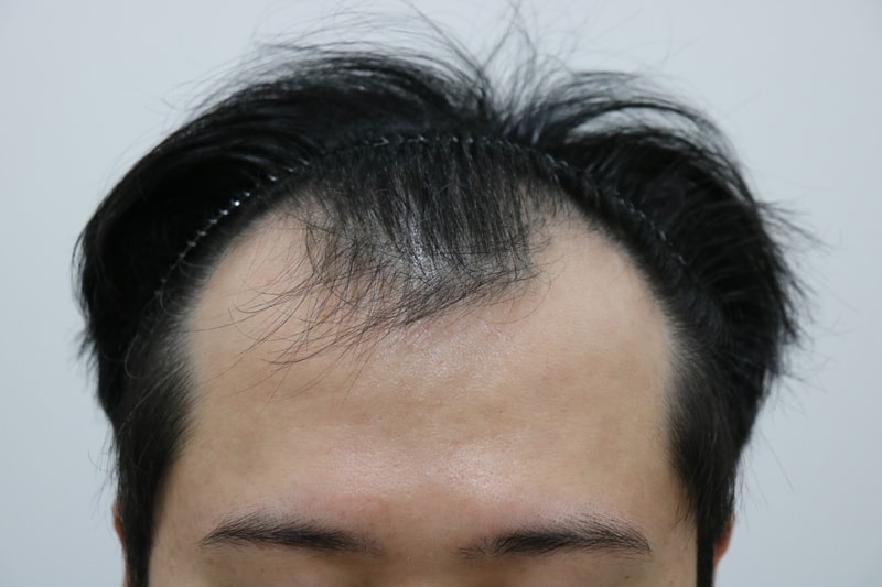 앞머리1.jpg