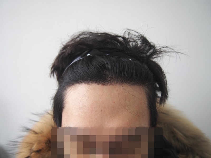 1년_정면.JPG