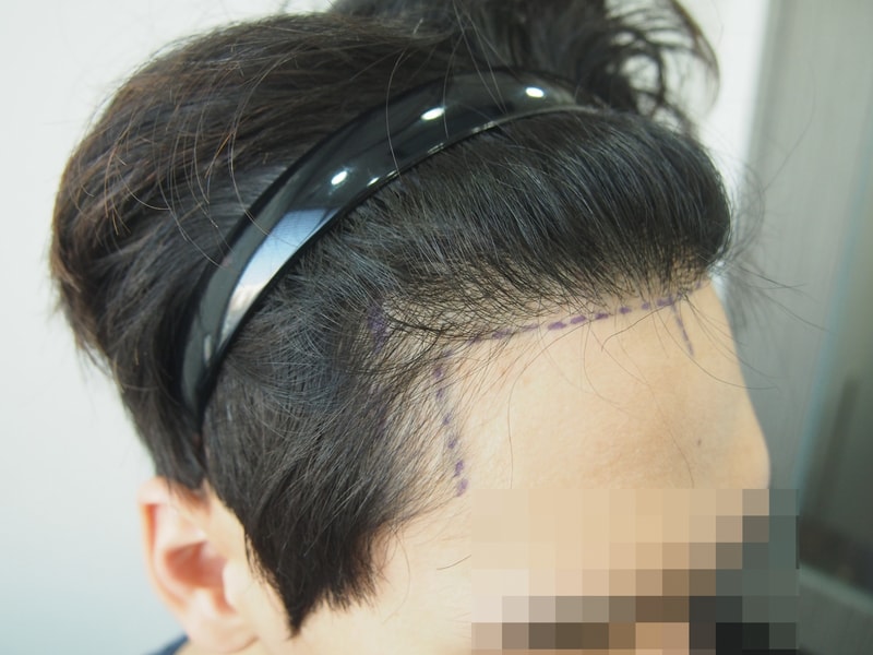 전_우측.JPG
