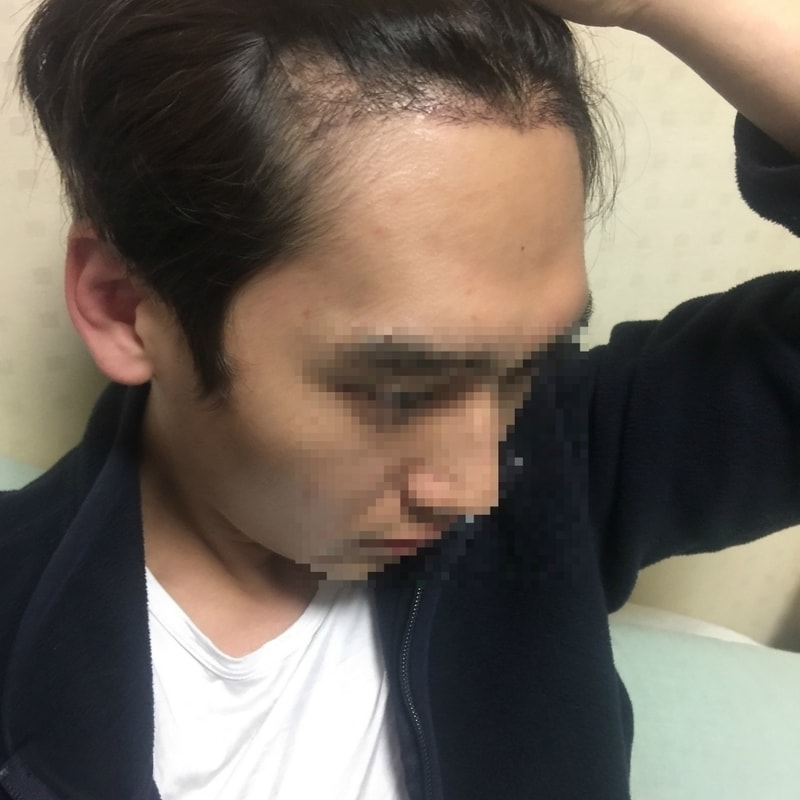 18일차_IMG_3554_pix.jpg