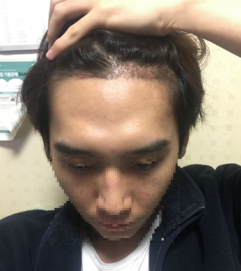 크기변환_18일차_IMG_3547_pix_자름.png