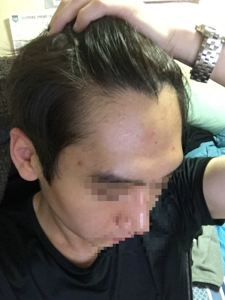 수술전_IMG_3014_픽셀화.jpg