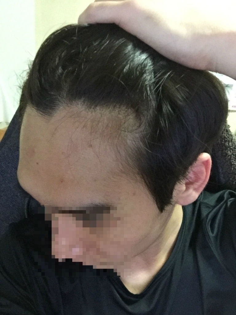 수술전__3015_픽셀화.jpg