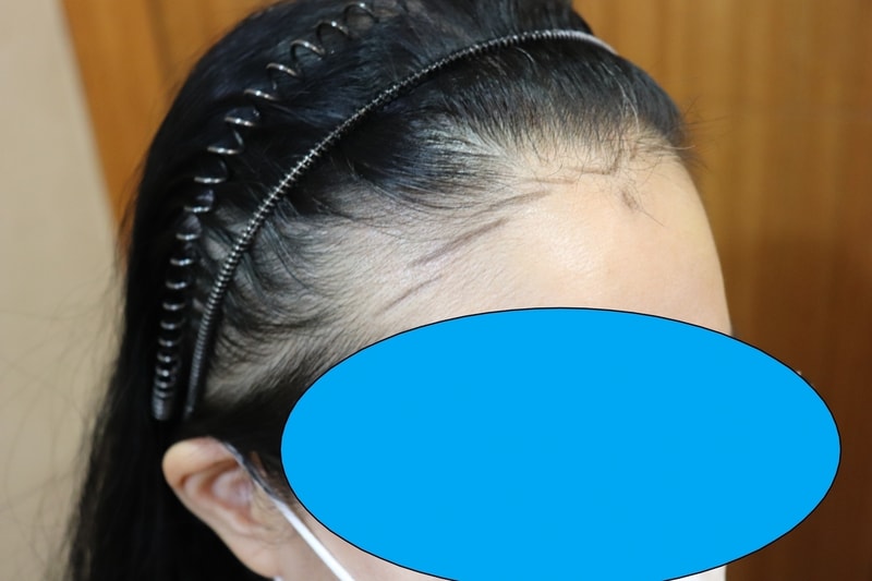 수술전5.jpg
