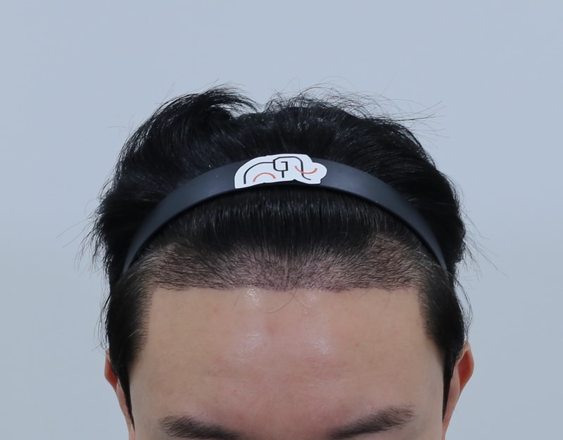 2주차 경과.jpeg