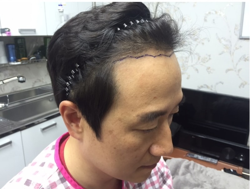 이미지 11.png