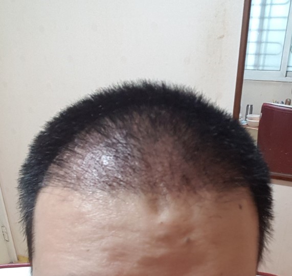 4개월 차