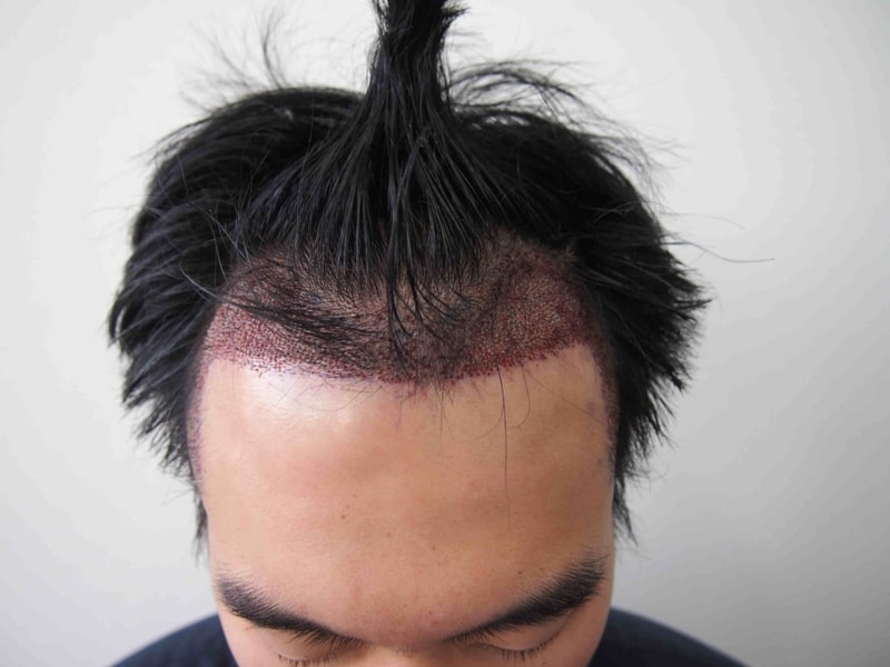 수술후1.JPG