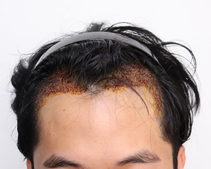 당일(1일차) 눈X.jpg