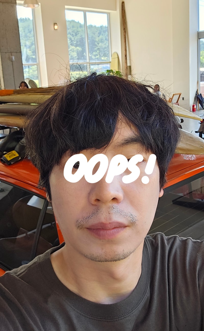 수술 전, 후 포토 후기 입니다