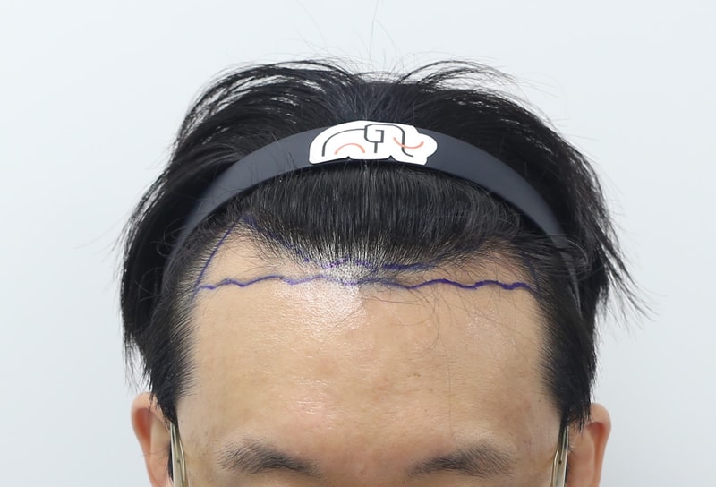 수술_01_전_240307.jpg